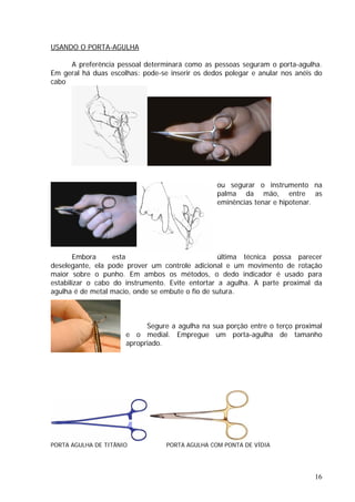 USANDO O PORTA-AGULHA
A preferência pessoal determinará como as pessoas seguram o porta-agulha.
Em geral há duas escolhas: pode-se inserir os dedos polegar e anular nos anéis do
cabo
ou segurar o instrumento na
palma da mão, entre as
eminências tenar e hipotenar.
Embora esta última técnica possa parecer
deselegante, ela pode prover um controle adicional e um movimento de rotação
maior sobre o punho. Em ambos os métodos, o dedo indicador é usado para
estabilizar o cabo do instrumento. Evite entortar a agulha. A parte proximal da
agulha é de metal macio, onde se embute o fio de sutura.
Segure a agulha na sua porção entre o terço proximal
e o medial. Empregue um porta-agulha de tamanho
apropriado.
PORTA AGULHA DE TITÂNIO PORTA AGULHA COM PONTA DE VÍDIA
16
 