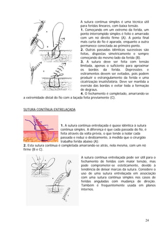 A sutura contínua simples é uma técnica útil
para feridas lineares, com baixa tensão.
1. Começando em um extremo da ferida, um
ponto interrompido simples é feito e amarrado
com um nó direito firme (A). A ponta final
mais curta do fio é aparada, enquanto a outra
permanece conectada ao primeiro ponto.
2. Outras passadas idênticas sucessivas são
feitas, dispostas simetricamente e sempre
começando do mesmo lado da ferida (B).
3. A sutura deve ser feita com tensão
limitada, apenas o suficiente para aproximar
os bordos da ferida. Depressões e
estiramentos devem ser evitados, pois podem
produzir o estrangulamento da ferida e uma
cicatrização insatisfatória. Deve ser mantida a
eversão das bordas e evitar toda a formação
al do fio com a laçada feita previamente (C).
de degraus.
4. O fechamento é completado, amarrando-se
a extremidade dist
SUTURA CONTÍNUA ENTRELAÇADA
1. A sutura contínua entrelaçada é quase idêntica à sutura
contínua simples. A diferença é que cada passada do fio, é
feita através da volta prévia, o que tende a isolar cada
passada e reduz o deslizamento, à medida que o cirurgião
trabalha ferida abaixo (A);
2. Esta sutura contínua é completada amarrando-se atrás, nela mesma, com um nó
firme (B e C).
A sutura contínua entrelaçada pode ser útil para o
fechamento de feridas com maior tensão, mas
pode comprometer-se esteticamente, devido à
tendência de deixar marcas da sutura. Considere o
uso de uma sutura entrelaçada em associação
com uma sutura contínua simples nos casos de
feridas anguladas com mudança de direção.
Também é frequentemente usada em planos
ternos.
in
24
 