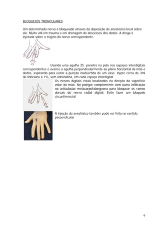 BLOQUEIOS TRONCULARES
Um determinado nervo é bloqueado através da deposição de anestésico local sobre
ele. Muito útil em trauma e em drenagem de abscessos dos dedos. A droga é
injetada sobre o trajeto do nervo correspondente.
Usando uma agulha 25 penetre na pele nos espaços interdigitais
correspondentes e avance a agulha perpendicularmente ao plano horizontal da mão e
dedos, aspirando para evitar a punção inadvertida de um vaso. Injete cerca de 3ml
de lidocaína a 1%, sem adrenalina, em cada espaço interdigital.
Os nervos digitais estão localizados na direção da superfície
volar da mão. No polegar complemente com outra infiltração
na articulação metacarpofalangeana para bloquear os ramos
dorsais do nervo radial digital. Evite fazer um bloqueio
circunferencial.
A injeção do anestésico também pode ser feita no sentido
perpendicular
9
 