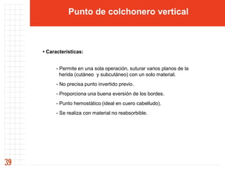Punto de colchonero vertical



     • Características:


           - Permite en una sola operación, suturar varios planos de la
             herida (cutáneo y subcutáneo) con un solo material.
           - No precisa punto invertido previo.
           - Proporciona una buena eversión de los bordes.
           - Punto hemostático (ideal en cuero cabelludo).
           - Se realiza con material no reabsorbible.




39
 