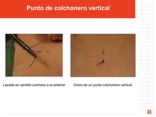 Punto de colchonero vertical




Lazada en sentido contrario a la anterior.   Visión de un punto colchonero vertical.




                                                                                       48
 