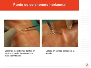 Punto de colchonero horizontal




Estirar de los extremos del hilo en   Lazada en sentido contrario a la
sentido opuesto, tensionando el       anterior.
nudo sobre la piel.



                                                                         58
 
