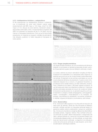 4.2.2.- Antidepresivos tricíclicos y antipsicóticos
En las intoxicaciones con antidepresivos tricíclicos y antipsicóti-
cos, el bicarbonato de sodio está indicado cuando existe
ensanchamiento del QRS mayor a 100 mseg, onda R en AVR
mayor a 3 mm, bloqueo de rama derecha, hipotensión arterial o
taquicardias ventriculares. Ante un ensanchamiento progresivo del
QRS o en pacientes con bloqueos AV de 2º o 3er grado, hay que
colocar un marcapasos transvenoso. Como ya se ha mencionado
previamente, en ocasiones se requieren umbrales de estimulación
más elevados, pudiendo no haber respuesta al marcapaso en
casos graves.
4.2.3.- Drogas simpáticomiméticas
Las drogas simpáticomiméticas, así como la abstinencia de fármacos
sedantes, se acompañan en general de taquicardia sinusal o auricu-
lar. Ocasionalmente pueden provocar fibrilación ventricular y muerte.
La cocaína, además de producir estimulación simpática al inhibir la
recaptación de noradrenalina, es un bloqueante sódico (Figura 6). La
isquemia que provoca el uso de cocaína también puede desencade-
nar arritmias. El tratamiento de las arritmias ventriculares por uso de
cocaína depende del tiempo de presentación. Cuando ocurren inme-
diatamente después de su consumo, en general el mecanismo es
por bloqueo de los canales sódicos y por ello, la lidocaína, procaina-
mida y antiarrítmcos de clases I y III pueden agravar la situación. El
uso de bicarbonato sódico es el tratamiento de elección. Cuando las
arritmias ventriculares asociadas al consumo de cocaína son tardías,
el mecanismo que las produce es, en general, la isquemia, por lo que
el tratamiento va dirigido a tratarla (antiagregantes y anticoagulantes,
nitratos, coronariografía y revascularización si es necesario). Sin
embargo, si las arritmias son persistentes o recurrentes, el tratamien-
to habitual, incluyendo la lidocaína y la amiodarona, está indicado.
4.2.4.- Alcohol etílico
En la intoxicación etílica aguda es muy frecuente la inducción de
varios tipos de arritmias, siendo las más frecuentes la fibrilación
auricular y el flutter auricular con respuesta ventricular rápida. En
general se prefiere evitar la cardioversión, porque son autolimita-
das. Es de suma importancia corregir las alteraciones electrolíticas
asociadas (potasio, magnesio, fósforo). Para controlar la frecuen-
cia ventricular se pueden utilizar ß-bloqueantes o antagonistas del
calcio, siempre teniendo en cuenta que si el paciente padece una
miocardiopatía dilatada enólica o de otra etiología, se puede dete-
riorar aún más la función ventricular. La digoxina no es útil para el
control de la frecuencia ventricular en esta situación, por la inten-
sa estimulación adrenérgica existente.
TOXICIDAD SOBRE EL APARATO CARDIOVASCULAR
FIGURA 5.- ECG DE UN PACIENTE CON INTOXICACIÓN POR ANTIHISTAMÍNICOS
(DIFENHIDRAMINA). RITMO SINUSAL CON QRS ESTRECHO. EN LAS DERIVACIONES
PRECORDIALES SE OBSERVA UNA MARCADA ELEVACIÓN DEL SEGMENTO ST EN
V2-V3 QUE SIMULA LA PATENTE DEL SÍNDROME DE BRUGADA. EL MECANISMO DE
ESTA ALTERACIÓN MORFOLÓGICA NO ES LA ISQUEMIA, SINO UNA ALTERACIÓN DE
LA CONDUCTANCIA IÓNICA POR BLOQUEO DE LOS CANALES DE SODIO. TAMBIÉN
SE OBSERVAN OTRAS ALTERACIONES DE LA REPOLARIZACIÓN (ONDAS T ALTAS Y
PICUDAS EN V4-V6). ESTAS Y OTRAS ALTERACIONES DE LA CONDUCCIÓN (BLO-
QUEOS DE RAMA, ENSANCHAMIENTO DEL QRS Y BLOQUEOS AV) TAMBIÉN SE
OBSERVAN EN LAS SOBREDOSIS DE COCAÍNA Y EN LAS INTOXICACIONES POR
ANTIARRÍTMICOS DEL GRUPO 1ª Y 1C, ANTIDEPRESIVOS TRICÍCLICOS Y ANTIPSICÓ-
TICOS.
FIGURA 6.- ECG EN UNA INTOXICACIÓN AGUDA POR COCAÍNA EN UN BODY-PAC-
KER. RITMO SINUSAL CON INTERVALO PR PROLONGADO (BLOQUEO AV DE 1ER
GRADO) Y ENSANCHAMIENTO DEL QRS (150 MSEG). EL EJE DEL COMPLEJO QRS
EN EL PLANO FRONTAL ESTÁ DESVIADO A LA DERECHA (POSIBLE TRASTORNO DE
CONDUCCIÓN EN EL FASCÍCULO POSTERIOR DEL HAZ DE HIS TIPO HEMIBLOQUEO
POSTERIOR) Y LA MORFOLOGÍA QR EN AVR Y V1 ASÍ COMO EL RETRASO DE LAS
FUERZAS FINALES EN I Y VL SUGIEREN ENLENTECIMIENTO EN LA CONDUCCIÓN EN
LA RAMA DERECHA (SÍMIL BLOQUEO DE RAMA DERECHA). EL INTERVALO QT TAM-
BIÉN ESTÁ PROLONGADO. EN CONCLUSIÓN, UN BLOQUEO TRIFASCICULAR CON
MARCADA ALTERACIÓN DE LA DESPOLARIZACIÓN, LA REPOLARIZACIÓN Y LA CON-
DUCCIÓN INFRAHISSIANA.
16
 
