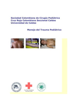 Sociedad Colombiana de Cirugía Pediátrica
Cruz Roja Colombiana Seccional Caldas
Universidad de Caldas
Manejo del Trauma Pediátrico
Cruz Roja Colombiana
Seccional Caldas
 