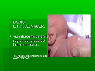  DOSISDOSIS
0.1 ml, AL NACER.0.1 ml, AL NACER.
 vía intradérmica en lavía intradérmica en la
región deltoidea delregión deltoidea del
brazo derecho .brazo derecho .
 SE PUEDE APLICAR HASTA LOS 14SE PUEDE APLICAR HASTA LOS 14
AÑOS DE EDAD.AÑOS DE EDAD.
 