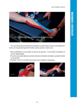 33
En caso de afectación del tendón de Aquiles se puede aplicar la técnica de tendón (ve-
remos en el apartado ligamento tendó) cuando pasamos sobre este.
• Otra posibilidad es la de aplicar la técnica de gemelo + la de tendón de Aquiles de
forma independiente.
• En este caso puede aplicarse primero la técnica de tendón de Aquiles y posteriormente
la de gemelo.
• Siempre “cerrar” en el talón para evitar que el vendaje se despegue.
Javier Rodríguez Palencia
MIEMBROINFERIOR
 