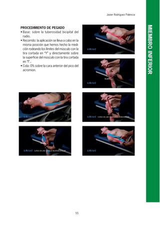 55
PROCEDIMIENTO DE PEGADO
• Base: sobre la tuberosidad bicipital del
radio.
• Recorrido: la aplicación se lleva a cabo en la
misma posición que hemos hecho la medi-
ción rodeando los límites del músculo con la
tira cortada en “Y” y directamente sobre
la superficie del músculo con la tira cortada
en “I”..
• Cola: 0% sobre la cara anterior del pico del
acromion.
Javier Rodríguez Palencia
MIEMBROINFERIOR
 
