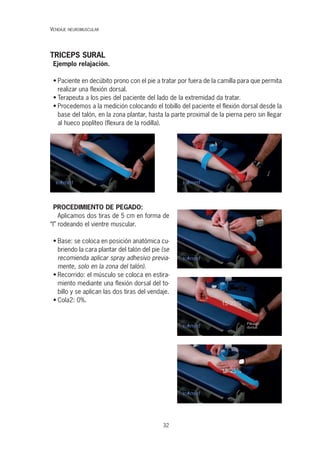 32
TRICEPS SURAL
Ejemplo relajación.
• Paciente en decúbito prono con el pie a tratar por fuera de la camilla para que permita
realizar una flexión dorsal.
• Terapeuta a los pies del paciente del lado de la extremidad da tratar.
• Procedemos a la medición colocando el tobillo del paciente el flexión dorsal desde la
base del talón, en la zona plantar, hasta la parte proximal de la pierna pero sin llegar
al hueco poplíteo (flexura de la rodilla).
PROCEDIMIENTO DE PEGADO:
Aplicamos dos tiras de 5 cm en forma de
“I” rodeando el vientre muscular.
• Base: se coloca en posición anatómica cu-
briendo la cara plantar del talón del pie (se
recomienda aplicar spray adhesivo previa-
mente, solo en la zona del talón).
• Recorrido: el músculo se coloca en estira-
miento mediante una flexión dorsal del to-
billo y se aplican las dos tiras del vendaje.
• Cola2: 0%.
VENDAJE NEUROMUSCULAR
 