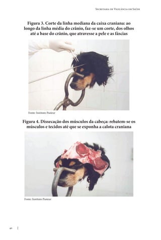 40
Secretaria de Vigilância em Saúde
Figura 3. Corte da linha mediana da caixa craniana: ao
longo da linha média do crânio, faz-se um corte, dos olhos
até a base do crânio, que atravesse a pele e as fáscias
Figura 4. Dissecação dos músculos da cabeça: rebatem-se os
músculos e tecidos até que se exponha a calota craniana
Fonte: Instituto Pasteur
Fonte: Instituto Pasteur
 
