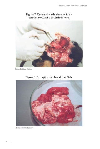 42
Secretaria de Vigilância em Saúde
Figura 7. Com a pinça de dissecação e a
tesoura se extrai o encéfalo inteiro
Figura 8. Extração completa do encéfalo
Fonte: Instituto Pasteur
Fonte: Instituto Pasteur
 