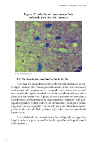52
Secretaria de Vigilância em Saúde
Figura 13. Inclusões de Lentz no neurônio
infectado pelo vírus da cinomose
4.2 Técnica de imunofluorescência direta
A técnica de imunofluorescência direta com utilização de an-
ticorpos fluorescentes (imunoglobulinas anti-rábicas marcadas com
isotiocianato de fluoresceína = conjugado anti-rábico) se constitui
em um método rápido, sensível e específico de diagnosticar a infec-
ção rábica em susceptíveis. A prova se baseia no exame microscópico
de impressões de fragmentos de tecido nervoso “tratados” com con-
jugado específico e submetidos à luz ultravioleta. O antígeno rábico,
reagindo com o conjugado e iluminado com luz ultravioleta (com-
primento de onda de 260 nanômetros), emite uma luz esverdeada
fluorescente.
A sensibilidade da imunofluorescência depende do espécime
(espécie animal e grau de autólise) e da experiência do profissional
de diagnóstico.
Fonte: Instituto Pasteur
 