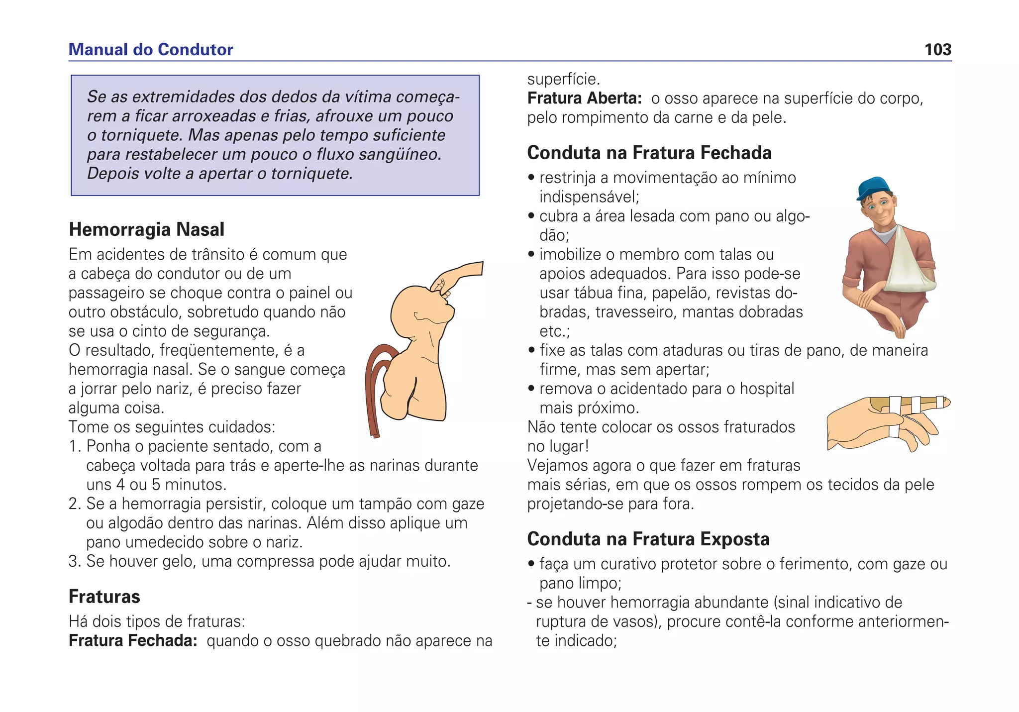 Hemorragia Nasal
Em acidentes de trânsito é comum que
a cabeça do condutor ou de um
passageiro se choque contra o painel ou
outro obstáculo, sobretudo quando não
se usa o cinto de segurança.
O resultado, freqüentemente, é a
hemorragia nasal. Se o sangue começa
a jorrar pelo nariz, é preciso fazer
alguma coisa.
Tome os seguintes cuidados:
1. Ponha o paciente sentado, com a
cabeça voltada para trás e aperte-lhe as narinas durante
uns 4 ou 5 minutos.
2. Se a hemorragia persistir, coloque um tampão com gaze
ou algodão dentro das narinas. Além disso aplique um
pano umedecido sobre o nariz.
3. Se houver gelo, uma compressa pode ajudar muito.
Fraturas
Há dois tipos de fraturas:
Fratura Fechada: quando o osso quebrado não aparece na
Se as extremidades dos dedos da vítima começa-
rem a ficar arroxeadas e frias, afrouxe um pouco
o torniquete. Mas apenas pelo tempo suficiente
para restabelecer um pouco o fluxo sangüíneo.
Depois volte a apertar o torniquete.
superfície.
Fratura Aberta: o osso aparece na superfície do corpo,
pelo rompimento da carne e da pele.
Conduta na Fratura Fechada
• restrinja a movimentação ao mínimo
indispensável;
• cubra a área lesada com pano ou algo-
dão;
• imobilize o membro com talas ou
apoios adequados. Para isso pode-se
usar tábua fina, papelão, revistas do-
bradas, travesseiro, mantas dobradas
etc.;
• fixe as talas com ataduras ou tiras de pano, de maneira
firme, mas sem apertar;
• remova o acidentado para o hospital
mais próximo.
Não tente colocar os ossos fraturados
no lugar!
Vejamos agora o que fazer em fraturas
mais sérias, em que os ossos rompem os tecidos da pele
projetando-se para fora.
Conduta na Fratura Exposta
• faça um curativo protetor sobre o ferimento, com gaze ou
pano limpo;
- se houver hemorragia abundante (sinal indicativo de
ruptura de vasos), procure contê-la conforme anteriormen-
te indicado;
Manual do Condutor 103
 