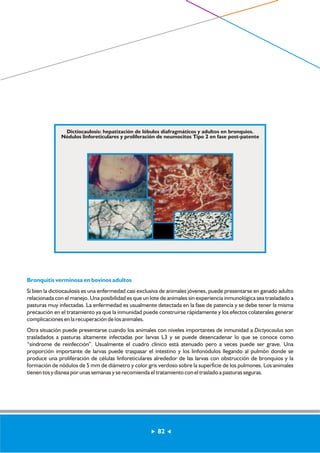 Dictiocaulosis: hepatización de lóbulos diafragmáticos y adultos en bronquios. 
Nódulos linforeticulares y proliferación de neumocitos Tipo 2 en fase post-patente 
Bronquitis verminosa en bovinos adultos 
Si bien la dictiocaulosis es una enfermedad casi exclusiva de animales jóvenes, puede presentarse en ganado adulto 
relacionada con el manejo. Una posibilidad es que un lote de animales sin experiencia inmunológica sea trasladado a 
pasturas muy infectadas. La enfermedad es usualmente detectada en la fase de patencia y se debe tener la misma 
precaución en el tratamiento ya que la inmunidad puede construirse rápidamente y los efectos colaterales generar 
complicaciones en la recuperación de los animales. 
Otra situación puede presentarse cuando los animales con niveles importantes de inmunidad a Dictyocaulus son 
trasladados a pasturas altamente infectadas por larvas L3 y se puede desencadenar lo que se conoce como 
“síndrome de reinfección”. Usualmente el cuadro clínico está atenuado pero a veces puede ser grave. Una 
proporción importante de larvas puede traspasar el intestino y los linfonódulos llegando al pulmón donde se 
produce una proliferación de células linforeticulares alrededor de las larvas con obstrucción de bronquios y la 
formación de nódulos de 5 mm de diámetro y color gris verdoso sobre la superficie de los pulmones. Los animales 
tienen tos y disnea por unas semanas y se recomienda el tratamiento con el traslado a pasturas seguras. 
82 
 