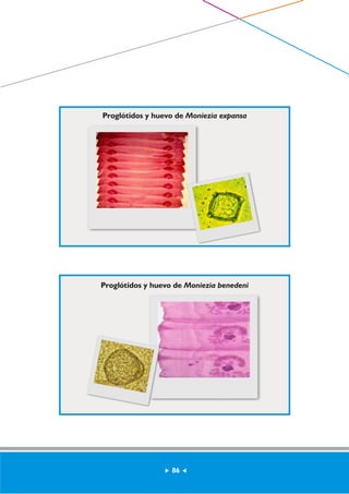 Proglótidos y huevo de Moniezia expansa 
Proglótidos y huevo de Moniezia benedeni 
86 
 