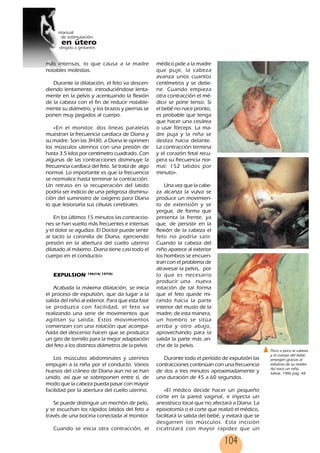 104
más intensas, lo que causa a la madre
notables molestias.
Durante la dilatación, el feto va descen-
diendo lentamente, introduciéndose lenta-
mente en la pelvis y acentuando la flexión
de la cabeza con el fin de reducir notable-
mente su diámetro, y los brazos y piernas se
ponen muy pegados al cuerpo.
«En el monitor, dos líneas paralelas
muestran la frecuencia cardíaca de Diana y
su madre. Son las 3H30, a Diana le oprimen
los músculos uterinos con una presión de
hasta 3.5 kilos por centímetro cuadrado. Con
algunas de las contracciones disminuye la
frecuencia cardíaca del feto. Se trata de algo
normal. Lo importante es que la frecuencia
se normalice hasta terminar la contracción.
Un retraso en la recuperación del latido
podría ser indicio de una peligrosa disminu-
ción del suministro de oxígeno para Diana
lo que lesionaría sus células cerebrales.
En los últimos 15 minutos las contraccio-
nes se han vuelto más frecuentes e intensas
y el dolor se agudiza. El Doctor puede sentir
al tacto la coronilla de Diana, ejerciendo
presión en la abertura del cuello uterino
dilatado al máximo. Diana tiene casi todo el
cuerpo en el conducto»
EXPULSION 106(16) 107(5)
Acabada la máxima dilatación, se inicia
el proceso de expulsión, que da lugar a la
salida del niño al exterior. Para que esta fase
se produzca con facilidad, el feto va
realizando una serie de movimientos que
agilitan su salida, Estos movimientos
comienzan con una rotación que acompa-
ñada del descenso hacen que se produzca
un giro de tornillo para la mejor adaptación
del feto a los distintos diámetros de la pelvis.
Los músculos abdominales y uterinos
empujan a la niña por el conducto. Varios
huesos del cráneo de Diana aun no se han
unido, así que se sobreponen entre sí, de
modo que la cabeza pueda pasar con mayor
facilidad por la abertura del cuello uterino.
Se puede distinguir un mechón de pelo,
y se escuchan los rápidos latidos del feto a
través de una bocina conectada al monitor.
Cuando se inicia otra contracción, el
médico pide a la madre
que puje, la cabeza
avanza unos cuantos
centímetros y se detie-
ne. Cuando empieza
otra contracción el mé-
dico se pone tenso. Si
el bebé no nace pronto,
es probable que tenga
que hacer una cesárea
o usar fórceps. La ma-
dre puja y la niña se
desliza hacia delante.
La contracción termina
y el corazón fetal recu-
pera su frecuencia nor-
mal: 152 latidos por
minuto».
Una vez que la cabe-
za alcanza la vulva se
produce un movimien-
to de extensión y se
yergue, de forma que
presenta la frente, ya
que, de persistir en la
flexión de la cabeza el
feto no podría salir.
Cuando la cabeza del
niño aparece al exterior
los hombros se encuen-
tran con el problema de
atravesar la pelvis, por
lo que es necesario
producir una nueva
rotación de tal forma
que el feto quede mi-
rando hacia la parte
interior del muslo de la
madre; de esta manera,
un hombro se sitúa
arriba y otro abajo,
aprovechando para la
salida la parte más an-
cha de la pelvis.
Durante todo el período de expulsión las
contracciones continúan con una frecuencia
de dos a tres minutos aproximadamente y
una duración de 45 a 60 segundos.
«El médico decide hacer un pequeño
corte en la pared vaginal, e inyecta un
anestésico local que no afectará a Diana. La
episiotomía o el corte que realizó el médico,
facilitará la salida del bebé, y evitará que se
desgarren los músculos. Esta incisión
cicatrizará con mayor rapidez que un
Poco a poco la cabeza
y el cuerpo del bebé,
emergen gracias al
esfuerzo de su madre.
Así nace un niño,
Salvat, 1986 pag. 48
104
 