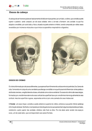 Escola Secundária de Montemor-o-Novo
Curso de Técnico de Apoio à Gestão
Desportiva
80 Estudo do Movimento/ Modulo1 – Osteologia e
Artrologia
Professora: SabinaTique
Ossos da cabeça
A cabeçadoser humanopodeser basicamentedivididaem duaspartes:porum lado, ocrânio,queconstituiaparte
superior e posterior, sendo composto por oito ossos soldados entre si, de modo a formarem uma cavidade na qual fica
alojado o encéfalo; por outro lado,a face, situada na parte anterior e inferior, sendo composta por vários ossos
revestidos por inúmeros músculos e que inicia os aparelhos respiratório e digestivo.
OSSOS DO CRÂNIO
O crânioéformadoporoitoossosdiferentes,queapenasficamfirmementeunidosentresiapartirdos 2ou3anosde
vida, formando em conjuntouma cavidadequealberga oencéfalo enaqualépossível diferenciarvárias partes:a
abóbadacraniana,aregiãolateraleabase,articuladacomacolunavertebral.Osossosdocrâniosãoossos largos,
formados por umalâminaexternadeosso cortical desuperfície lisae por umalâminainternaigualmentede osso
cortical, mas de superfície rugosa, separadas entre si por uma camada de osso trabecular.
O frontal, um osso ímpar, constitui a parte anterior e superior do crânio, embora a sua parte inferior pertença
à formaçãodabase.Nafrente, écompostopordoisângulosduros queapresentamalgumasdepressõesporbaixo,
constituindo a parte superior das cavidades orbitárias onde ficam os olhos. Por cima deste sector existem dois espaços
ocos, um de cada lado, que correspondem aos seios frontais.
 