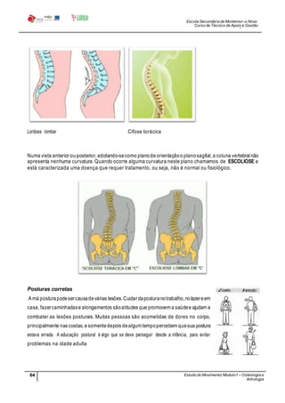Escola Secundária de Montemor-o-Novo
Curso de Técnico de Apoio à Gestão
Desportiva
64 Estudo do Movimento/ Modulo1 – Osteologia e
Artrologia
Professora: SabinaTique
Lordose lombar Cifose torácica
Numa vista anterior ou posterior, adotando-secomo planode orientaçãoo planosagital, a coluna vertebral não
apresenta nenhuma curvatura. Quando ocorre alguma curvatura neste plano chamamos de ESCOLIOSE e
está caracterizada uma doença que requer tratamento, ou seja, não é normal ou fisiológico.
Posturas corretas
A má posturapodesercausadevárias lesões.Cuidardaposturanotrabalho,nolazereem
casa, fazercaminhadase alongamentos sãoatitudes que promovem a saúdee ajudam a
combater as lesões posturais. Muitas pessoas são acometidas de dores no corpo,
principalmente nas costas, e somentedepois dealgum tempopercebem quesua postura
estava errada. A educação postural é algo que se deve perseguir desde a infância, para evitar
problemas na idade adulta
 