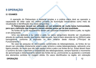 5 OPERAÇÃO
5.1 EXAMES

       A operação do Fleboscópio é bastante simples e a prática diária dará ao operador a
capacidade de obter cada vez melhor proveito da iluminação transcutânea como meio de
visualização e identificação dos vasos sanguíneos.
        O Fleboscópio deverá ser utilizado em um ambiente de muito baixa luminosidade,
para que a definição das imagens a serem obtidas possa ser de boa qualidade.
        As fontes de luz do equipamento devem ser aplicadas diretamente sobre a pele, na região
a ser pesquisada.
        Uma vez aplicada a luz sobre a pele, os vasos sanguíneos deverão ser visualizados
através do contraste destes, que ficarão mais escuros, face à maior absorção da luz (625nm) pela
hemoglobina, conforme já explicado no item anterior deste manual (“Princípio de
Funcionamento”).
        No caso de pesquisa de microvarizes combinadas às teleangiectasias, as fontes de luz
devem ser colocadas diretamente sobre a pele, próximo a estas teleangiectasias, aplicando uma
ligeira pressão, de modo que não haja espaço entre a pele e as fontes de luz. Estas devem fazer
o contorno de todo o perímetro e adjacências das teleangiectasias, sempre fazendo o movimento
de aproximação e distanciamento lateral das fontes de luz, promovendo ou ajustando o contraste
dos elementos contidos na imagem obtida. Os vasos identificados na região, em coloração
 OPERAÇÃO                                                                            12
 