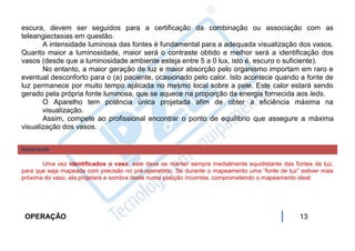 escura, devem ser seguidos para a certificação da combinação ou associação com as
teleangiectasias em questão.
       A intensidade luminosa das fontes é fundamental para a adequada visualização dos vasos.
Quanto maior a luminosidade, maior será o contraste obtido e melhor será a identificação dos
vasos (desde que a luminosidade ambiente esteja entre 5 a 0 lux, isto é, escuro o suficiente).
       No entanto, a maior geração de luz e maior absorção pelo organismo importam em raro e
eventual desconforto para o (a) paciente, ocasionado pelo calor. Isto acontece quando a fonte de
luz permanece por muito tempo aplicada no mesmo local sobre a pele. Este calor estará sendo
gerado pela própria fonte luminosa, que se aquece na proporção da energia fornecida aos leds.
       O Aparelho tem potência única projetada afim de obter a eficiência máxima na
       visualização.
       Assim, compete ao profissional encontrar o ponto de equilíbrio que assegure a máxima
visualização dos vasos.


Importante

       Uma vez identificados o vaso, este deve se manter sempre medialmente equidistante das fontes de luz,
para que seja mapeada com precisão no pré-operatório. Se durante o mapeamento uma “fonte de luz” estiver mais
próxima do vaso, ela projetará a sombra deste numa posição incorreta, comprometendo o mapeamento ideal.




 OPERAÇÃO                                                                                        13
 