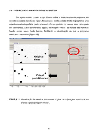 5.1 - VERIFICANDO A IMAGEM DE UMA AMOSTRA
Em alguns casos, podem surgir dúvidas sobre a interpretação do programa, do
que ele considera mancha de “gota”. Nesse caso, existe ao lado direito do programa, uma
caixinha quadrada grafada “preto e branco”. Com o ponteiro do mouse, essa caixa pode
ser selecionada. Ao se acionar essa opção, na imagem “virtual”, as marcas das manchas
ficarão pretas sobre fundo branco, facilitando a identificação do que o programa
considerou na análise (Figura 11).
FIGURA 11. Visualização da amostra, em sua cor original cinza (imagem superior) e em
branco e preto (imagem inferior).
17
Original
cinza
Virtual
preto&branco
 