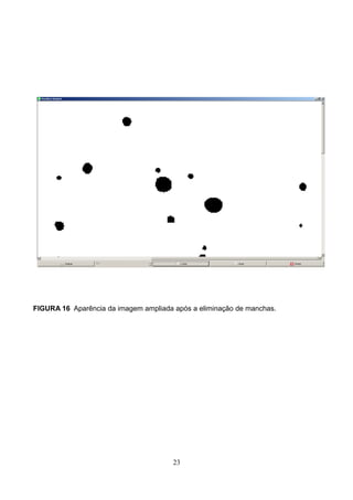 FIGURA 16 Aparência da imagem ampliada após a eliminação de manchas.
23
 