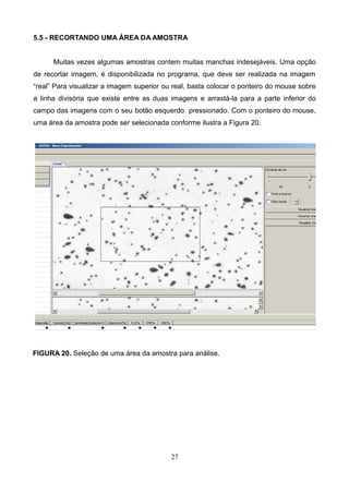 5.5 - RECORTANDO UMA ÁREA DA AMOSTRA
Muitas vezes algumas amostras contem muitas manchas indesejáveis. Uma opção
de recortar imagem, é disponibilizada no programa, que deve ser realizada na imagem
“real” Para visualizar a imagem superior ou real, basta colocar o ponteiro do mouse sobre
a linha divisória que existe entre as duas imagens e arrastá-la para a parte inferior do
campo das imagens com o seu botão esquerdo pressionado. Com o ponteiro do mouse,
uma área da amostra pode ser selecionada conforme ilustra a Figura 20.
FIGURA 20. Seleção de uma área da amostra para análise.
27
 