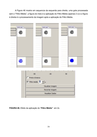 A Figura 46 mostra em sequencia da esquerda para direita, uma gota processada
sem o “Filtro Média”, a figura do meio é a aplicação do Filtro Média (apenas 2 x) e a figura
à direita é o processamento da imagem após a aplicação do Filtro Média.
FIGURA 46. Efeito da aplicação do “Filtro Média” em 2x
54
 