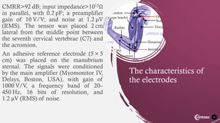 CMRR>92 dB; input impedance>1015Ω
in parallel, with 0.2 pF; a preamplifier
gain of 10 V/V; and noise at 1.2 μV
(RMS). The sensor was placed 2 cm
lateral from the middle point between
the seventh cervical vertebrae (C7) and
the acromion.
An adhesive reference electrode (5 × 5
cm) was placed on the manubrium
sternal. The signals were conditioned
by the main amplifier (Myomonitor IV,
Delsys, Boston, USA), with gain of
1000 V/V, a frequency band of 20–
450 Hz, 16 bits of resolution, and
1.2 μV (RMS) of noise.
14
The characteristics of
the electrodes
 