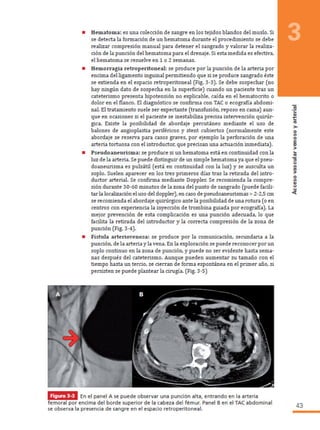 Manual hemodinamica 2 cap 3
