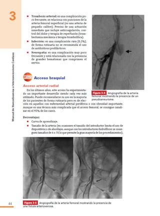 Manual hemodinamica 2 cap 3