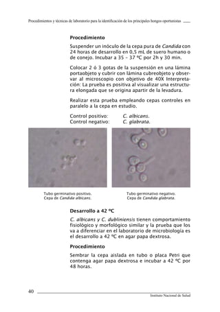 40
Instituto Nacional de Salud
Procedimientos y técnicas de laboratorio para la identificación de los principales hongos oportunistas
Procedimiento
Suspender un inóculo de la cepa pura de Candida con
24 horas de desarrollo en 0,5 mL de suero humano o
de conejo. Incubar a 35 – 37 ºC por 2h y 30 min.
Colocar 2 ó 3 gotas de la suspensión en una lámina
portaobjeto y cubrir con lámina cubreobjeto y obser-
var al microscopio con objetivo de 40X Interpreta-
ción: La prueba es positiva al visualizar una estructu-
ra elongada que se origina apartir de la levadura.
Realizar esta prueba empleando cepas controles en
paralelo a la cepa en estudio.
Control positivo:	 C. albicans.
Control negativo:	 C. glabrata.
Desarrollo a 42 ºC
C. albicans y C. dubliniensis tienen comportamiento
fisiológico y morfológico similar y la prueba que los
va a diferenciar en el laboratorio de microbiología es
el desarrollo a 42 ºC en agar papa dextrosa.
Procedimiento
Sembrar la cepa aislada en tubo o placa Petri que
contenga agar papa dextrosa e incubar a 42 ºC por
48 horas.
Tubo germinativo negativo.
Cepa de Candida glabrata.
Tubo germinativo positivo.
Cepa de Candida albicans.
Manual de Procedimiento.indd 40 14/9/07 14:40:33
 