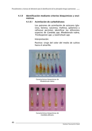 46
Instituto Nacional de Salud
Procedimientos y técnicas de laboratorio para la identificación de los principales hongos oportunistas
4.1.9	 Identificación mediante criterios bioquímicos y enzi-
máticos
4.1.9.1	 Asimilación de carbohidratos
Los patrones de asimilación de azúcares (glu-
cosa, lactosa, sacarosa, maltosa, galactosa y
rafinosa) permiten identificar las diferentes
especies de Candida spp, Rhodotorula rubra,
Trichosporon spp. y Geotrichum spp.
Interpretación:
Positivo: viraje del color del medio de cultivo
hacia el amarillo.
Características bioquímicas de
Candida albicans.
Características bioquímicas de
Rhodotorula rubra.
Glu Sac Mal Raf Lac Gal Ure
Glu Lac Sac Gal Mal Raf
Manual de Procedimiento.indd 46 14/9/07 14:40:42
 