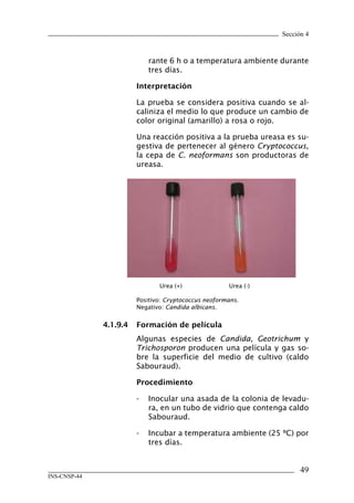 Sección 4
49
INS-CNSP-44
rante 6 h o a temperatura ambiente durante
tres días.
Interpretación
La prueba se considera positiva cuando se al-
caliniza el medio lo que produce un cambio de
color original (amarillo) a rosa o rojo.
Una reacción positiva a la prueba ureasa es su-
gestiva de pertenecer al género Cryptococcus,
la cepa de C. neoformans son productoras de
ureasa.
Positivo: Cryptococcus neoformans.
Negativo: Candida albicans.
4.1.9.4	 Formación de película
Algunas especies de Candida, Geotrichum y
Trichosporon producen una película y gas so-
bre la superficie del medio de cultivo (caldo
Sabouraud).
Procedimiento
-	 Inocular una asada de la colonia de levadu-
ra, en un tubo de vidrio que contenga caldo
Sabouraud.
-	 Incubar a temperatura ambiente (25 ºC) por
tres días.
Urea (-)Urea (+)
Manual de Procedimiento.indd 49 14/9/07 14:40:45
 