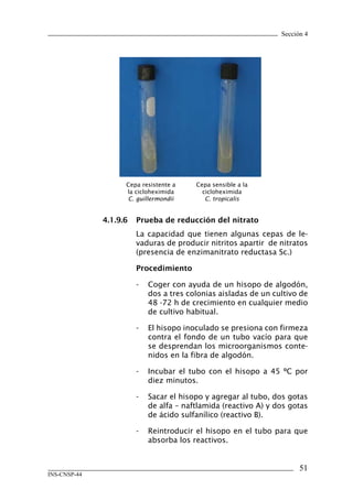 Sección 4
51
INS-CNSP-44
Cepa resistente a
la cicloheximida
C. guillermondii
Cepa sensible a la
cicloheximida
C. tropicalis
4.1.9.6	 Prueba de reducción del nitrato
La capacidad que tienen algunas cepas de le-
vaduras de producir nitritos apartir de nitratos
(presencia de enzimanitrato reductasa Sc.)
Procedimiento
-	 Coger con ayuda de un hisopo de algodón,
dos a tres colonias aisladas de un cultivo de
48 -72 h de crecimiento en cualquier medio
de cultivo habitual.
-	 El hisopo inoculado se presiona con firmeza
contra el fondo de un tubo vacío para que
se desprendan los microorganismos conte-
nidos en la fibra de algodón.
-	 Incubar el tubo con el hisopo a 45 ºC por
diez minutos.
-	 Sacar el hisopo y agregar al tubo, dos gotas
de alfa – naftlamida (reactivo A) y dos gotas
de ácido sulfanílico (reactivo B).
-	 Reintroducir el hisopo en el tubo para que
absorba los reactivos.
Manual de Procedimiento.indd 51 14/9/07 14:40:47
 