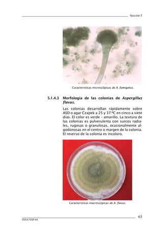 Sección 5
63
INS-CNSP-44
5.1.4.3	 Morfología de las colonias de Aspergillus
flavus.
Las colonias desarrollan rápidamente sobre
ASD o agar Czapek a 25 y 37 ºC en cinco a siete
días. El color es verde – amarillo. La textura de
las colonias es pulverulenta con surcos radia-
les, rugosas o granulosas, ocasionalmente al-
godonosas en el centro o margen de la colonia.
El reverso de la colonia es incoloro.
Caracteristicas microscópicas de A. fumigatus.
Caracteristicas macroscópicas de A. flavus.
Manual de Procedimiento.indd 63 14/9/07 14:40:56
 