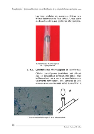 68
Instituto Nacional de Salud
Procedimientos y técnicas de laboratorio para la identificación de los principales hongos oportunistas
Las cepas aisladas de muestras clínicas rara-
mente desarrollan la fase sexual. Crece sobre
medios de cultivo que contienen clorhexidina.
5.1.6.2.	 Características microscópicas de las colonias.
Células conidiógenas (anélides) casi cilíndri-
cas, se desarrollan directamente sobre hifas
indiferenciadas o a partir de conidióforos es-
casamente ramificados. Los conidios se acu-
mulan en masas mucosas sobre las anélides o
Caracteristicas macroscópicas
de S. apiospermum.
Caracteristicas microscópicas de S. apiospermum.
A
Manual de Procedimiento.indd 68 14/9/07 14:41:02
 