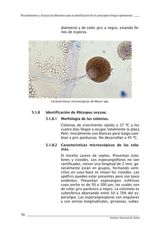 70
Instituto Nacional de Salud
Procedimientos y técnicas de laboratorio para la identificación de los principales hongos oportunistas
diámetro) y de color gris a negro, estando lle-
nos de esporas.
5.1.8	 Identificación de Rhizopus oryzae.
5.1.8.1	 Morfología de las colonias.
Colonias de crecimiento rápido a 37 ºC a los
cuatro días llegan a ocupar totalmente la placa
Petri. Inicialmente son blancas pero luego cam-
bian a gris parduscas. No desarrollan a 45 ºC.
5.1.8.2	 Características microscópicas de las colo-
nias.
El micelio carece de septos. Presentan esto-
lones y rizoides. Los esporangióforos no son
ramificados, tienen una longitud de 2 mm, ge-
neralmente están en grupos, formando verti-
cilios en cuya base se sitúan los rizoides. Las
apófisis pueden estar presentes pero son poco
evidentes. Presentan esporangios esféricos
cuyo ancho es de 50 a 300 μm, los cuales son
de color gris pardusco a negro. La columela es
subesférica abarcando entre 50 a 70% del es-
porangio. Las esporangiosporas son angulares
y con estrías longitudinales, grisáceas, subes-
Caracteristicas microscópicas de Mucor spp.
Manual de Procedimiento.indd 70 14/9/07 14:41:03
 