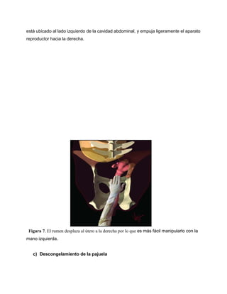está ubicado al lado izquierdo de la cavidad abdominal, y empuja ligeramente el aparato 
reproductor hacia la derecha. 
Figura 7. El rumen desplaza al útero a la derecha por lo que es más fácil manipularlo con la 
mano izquierda. 
c) Descongelamiento de la pajuela 
 