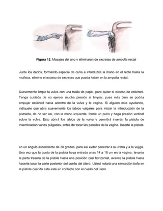 Figura 12. Masajes del ano y eliminaron de excretas de ampolla rectal 
Junte los dedos, formando especie de cuña e introduzca la mano en el recto hasta la 
muñeca, elimine el exceso de excretas que pueda haber en la ampolla rectal. 
Suavemente limpie la vulva con una toalla de papel, para quitar el exceso de estiércol. 
Tenga cuidado de no ejercer mucha presión al limpiar, pues más bien se podría 
empujar estiércol hacia adentro de la vulva y la vagina. Si alguien esta ayudando, 
indíquele que abra suavemente los labios vulgares para iniciar la introducción de la 
pistoleta, de no ser así, con la mano izquierda, forme un puño y haga presión vertical 
sobre la vulva. Esto abrirá los labios de la vulva y permitirá insertar la pistola de 
inseminación varias pulgadas, antes de tocar las paredes de la vagina. Inserte la pistola 
en un ángulo ascendente de 30 grados, para así evitar penetrar a la uretra y a la vejiga. 
Una vez que la punta de la pistola haya entrado unas 14 a 18 cm en la vagina, levante 
la parte trasera de la pistola hasta una posición casi horizontal, avance la pistola hasta 
hacerla tocar la parte posterior del cuello del útero. Usted notará una sensación bofa en 
la pistola cuando esta esté en contacto con el cuello del útero. 
 