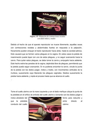 Figura. 15 Dilatación de contracciones rectales 
con dedo índice y medio 
Debido al hecho de que el aparato reproductor se mueve libremente, aquellas vacas 
con contracciones rectales y abdominales fuertes en respuesta a la palpación, 
físicamente pueden empujar el tracto reproductor hacia atrás, hasta la cavidad pélvica. 
Esto causará que se formen varios pliegues en la vagina. En estos casos la pistola de 
inseminación puede topar con uno de estos pliegues, y no seguir avanzando hacia la 
cervix. Para quitar estos pliegues, se debe tomar la cervix y empujarlo hacia adelante. 
Este hecho estira las paredes de la vagina, dejándola libre de pliegues, permitiendo que 
la pistola pueda seguir avanzando. Si no pudieras encontrar la cervix, circule la punta 
de la pistola con los dedos pulgar, índice y medio, con movimientos verticales de la 
muñeca, suavemente vaya liberando los pliegues vaginales. Deslice suavemente la 
pistola hacia adelante, y repita el proceso hasta que se alcance el cuello. 
. 
Tome el cuello uterino con la mano izquierda y con el dedo meñique ubique la punta de 
la pistoleta en el orificio de entrada del cuello uterino o tomando con los dedos pulgar e 
índice alrededor del fornix para reducirlo y 
que la pistoleta entre directo al 
conducto del cuello uterino 
 