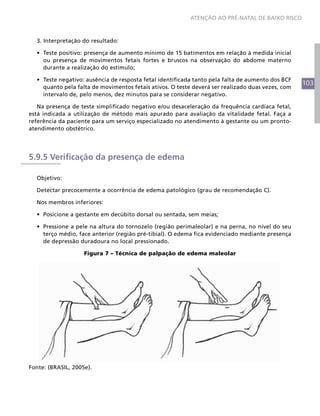 103
ATENÇÃO AO PRÉ-NATAL DE BAIXO RISCO
3. Interpretação do resultado:
•	 Teste positivo: presença de aumento mínimo de 15 batimentos em relação à medida inicial
ou presença de movimentos fetais fortes e bruscos na observação do abdome materno
durante a realização do estímulo;
•	 Teste negativo: ausência de resposta fetal identificada tanto pela falta de aumento dos BCF
quanto pela falta de movimentos fetais ativos. O teste deverá ser realizado duas vezes, com
intervalo de, pelo menos, dez minutos para se considerar negativo.
Na presença de teste simplificado negativo e/ou desaceleração da frequência cardíaca fetal,
está indicada a utilização de método mais apurado para avaliação da vitalidade fetal. Faça a
referência da paciente para um serviço especializado no atendimento à gestante ou um pronto-
atendimento obstétrico.
5.9.5 Verificação da presença de edema
Objetivo:
Detectar precocemente a ocorrência de edema patológico (grau de recomendação C).
Nos membros inferiores:
•	 Posicione a gestante em decúbito dorsal ou sentada, sem meias;
•	 Pressione a pele na altura do tornozelo (região perimaleolar) e na perna, no nível do seu
terço médio, face anterior (região pré-tibial). O edema fica evidenciado mediante presença
de depressão duradoura no local pressionado.
Figura 7 – Técnica de palpação de edema maleolar
Fonte: (BRASIL, 2005e).
 