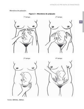 93
ATENÇÃO AO PRÉ-NATAL DE BAIXO RISCO
Manobras de palpação:
Figura 2 – Manobras de palpação
			1º tempo					2º tempo
			3º tempo					4º tempo
Fonte: (BRASIL, 2005e).
 