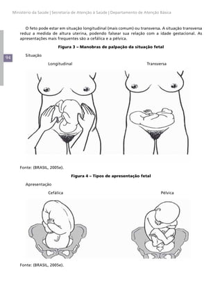 94
Ministério da Saúde | Secretaria de Atenção à Saúde | Departamento de Atenção Básica
O feto pode estar em situação longitudinal (mais comum) ou transversa. A situação transversa
reduz a medida de altura uterina, podendo falsear sua relação com a idade gestacional. As
apresentações mais frequentes são a cefálica e a pélvica.
Figura 3 – Manobras de palpação da situação fetal
Situação
		Longitudinal						Transversa
Fonte: (BRASIL, 2005e).
Figura 4 – Tipos de apresentação fetal
Apresentação
		Cefálica							Pélvica
Fonte: (BRASIL, 2005e).
 