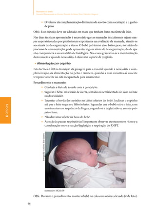 98
Ministério da Saúde
Atenção Humanizada ao Recém-Nascido de Baixo Peso: Método Canguru
Módulo3
▶▶ O volume da complementação diminuirá de acordo com a aceitação e o ganho
de peso.
OBS.: Este método deve ser adotado em mães que tenham fluxo excelente de leite.
Nas duas técnicas apresentadas é necessário que as mamadas inicialmente sejam sem‑
pre supervisionadas por profissionais experientes em avaliação da mamada, atendo‑se
aos sinais de desorganização e stress. O bebê pré‑termo e/ou baixo peso, no início do
processo de amamentação, pode apresentar alguns sinais de desorganização, desde que
não comprometa a sua estabilidade fisiológica. Nos casos graves faz‑se a monitorização
desta sucção e quando necessário, é oferecido suporte de oxigênio.
▶▶ Alimentação por copinho
Esta técnica é útil na transição da gavagem para a via oral quando é necessária a com‑
plementação da alimentação no peito e também, quando a mãe encontra‑se ausente
temporariamente ou está incapacitada para amamentar.
Procedimento e manuseio:
▶▶ Conferir a dieta de acordo com a prescrição.
▶▶ Segurar o bebê, em estado de alerta, sentado ou semissentado no colo da mãe
ou do cuidador.
▶▶ Encostar a borda do copinho no lábio inferior do bebê. Inclinar o copinho
até que o leite toque seu lábio inferior. Aguardar que o bebê retire o leite, com
movimentos em sequência da língua, sugando‑o e deglutindo‑o, em seu pró‑
prio ritmo.
▶▶ Não derramar o leite na boca do bebê.
▶▶ Atenção às pausas respiratórias! Importante observar atentamente o ritmo e a
coordenação entre a sucção/deglutição e respiração do RNPT.
Instituição: HGIS/SP
OBS.: Durante o procedimento, manter o bebê no colo com o tórax elevado (vide foto).
Fotográfa:AndreadosSantos
 