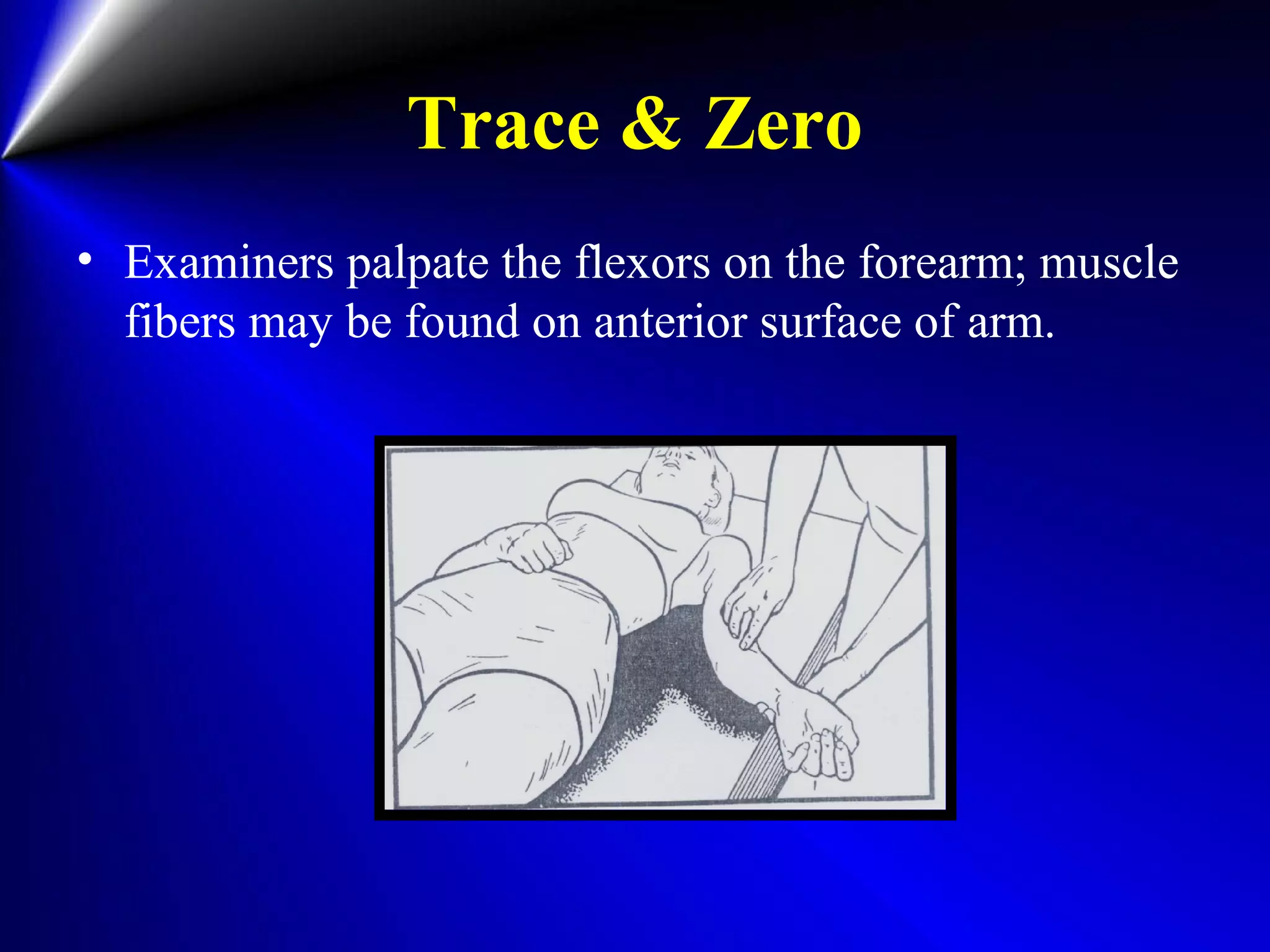 Trace & Zero
• Examiners palpate the flexors on the forearm; muscle
fibers may be found on anterior surface of arm.
 