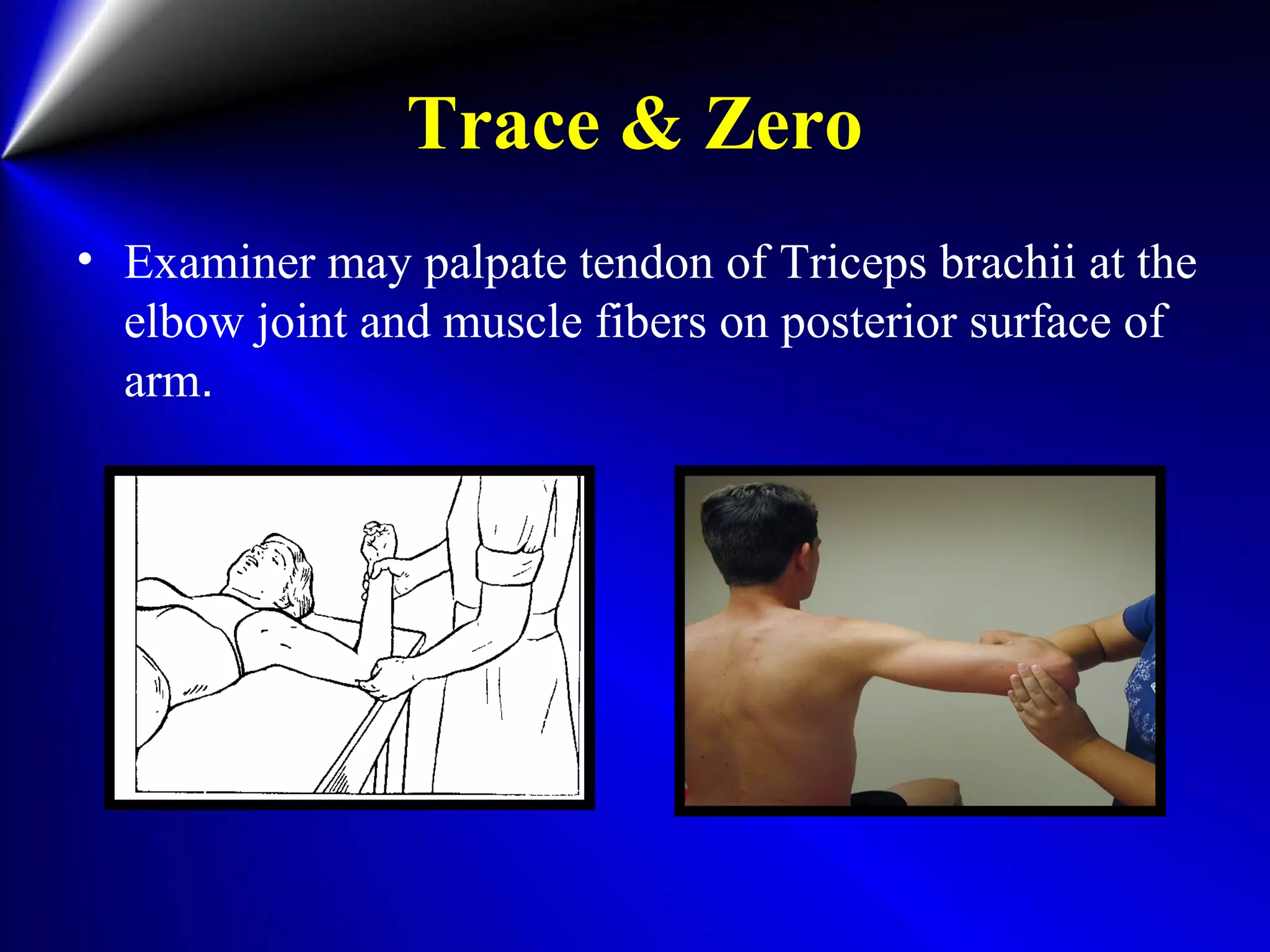 Trace & Zero
• Examiner may palpate tendon of Triceps brachii at the
elbow joint and muscle fibers on posterior surface of
arm.
 