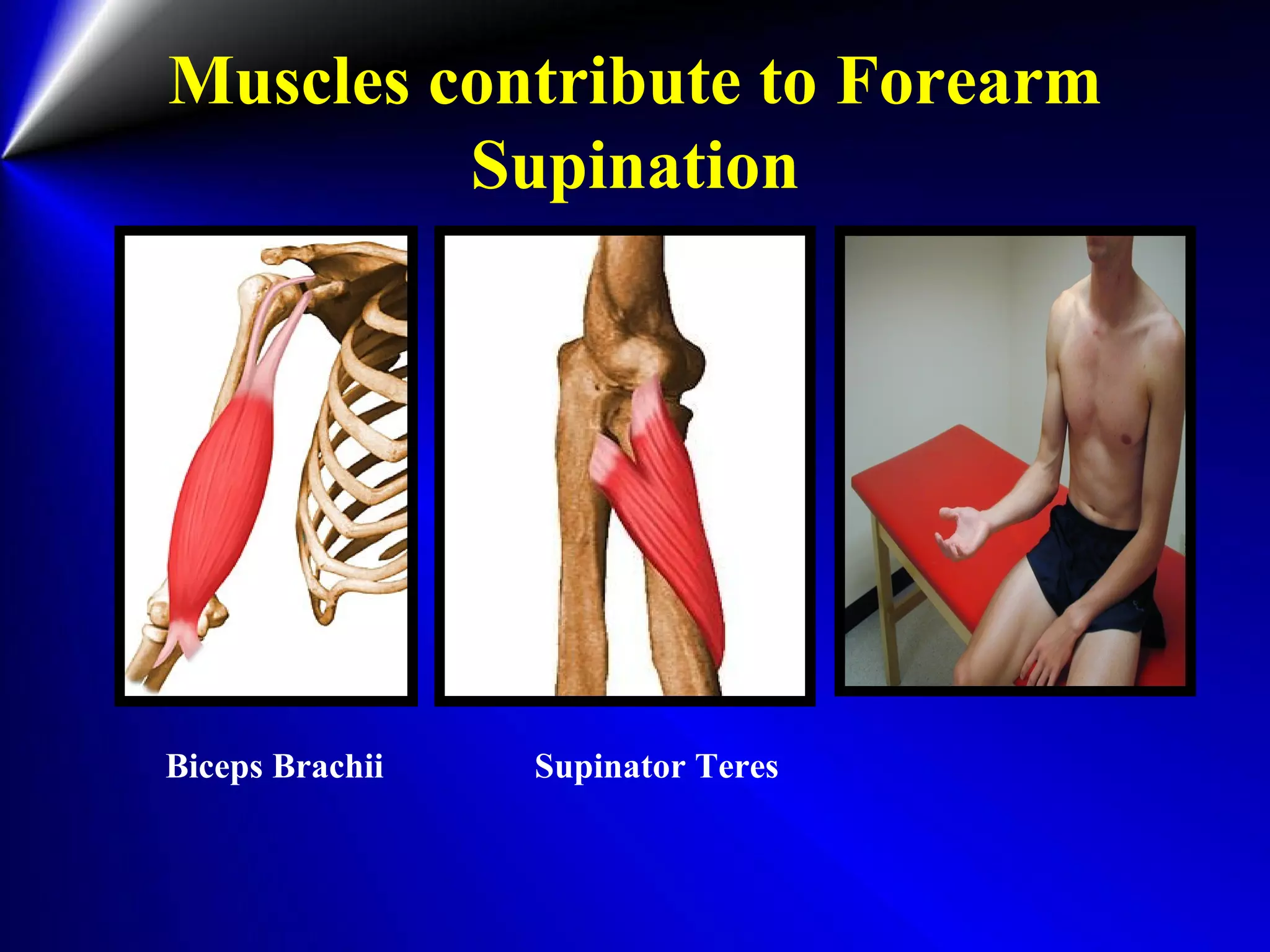 Muscles contribute to Forearm
Supination
Biceps Brachii Supinator Teres
 