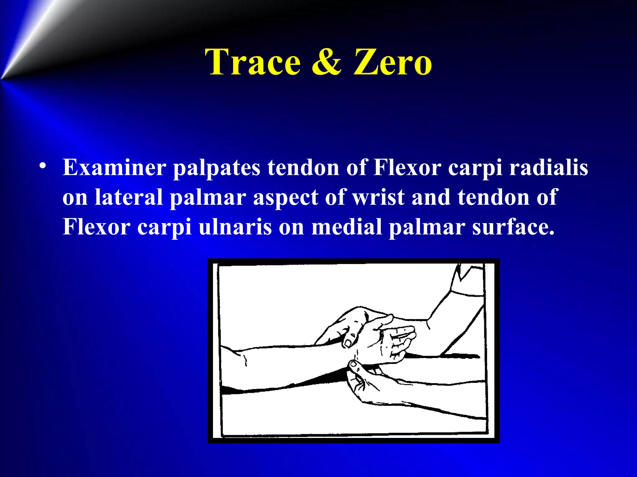 Trace & Zero
• Examiner palpates tendon of Flexor carpi radialis
on lateral palmar aspect of wrist and tendon of
Flexor carpi ulnaris on medial palmar surface.
 
