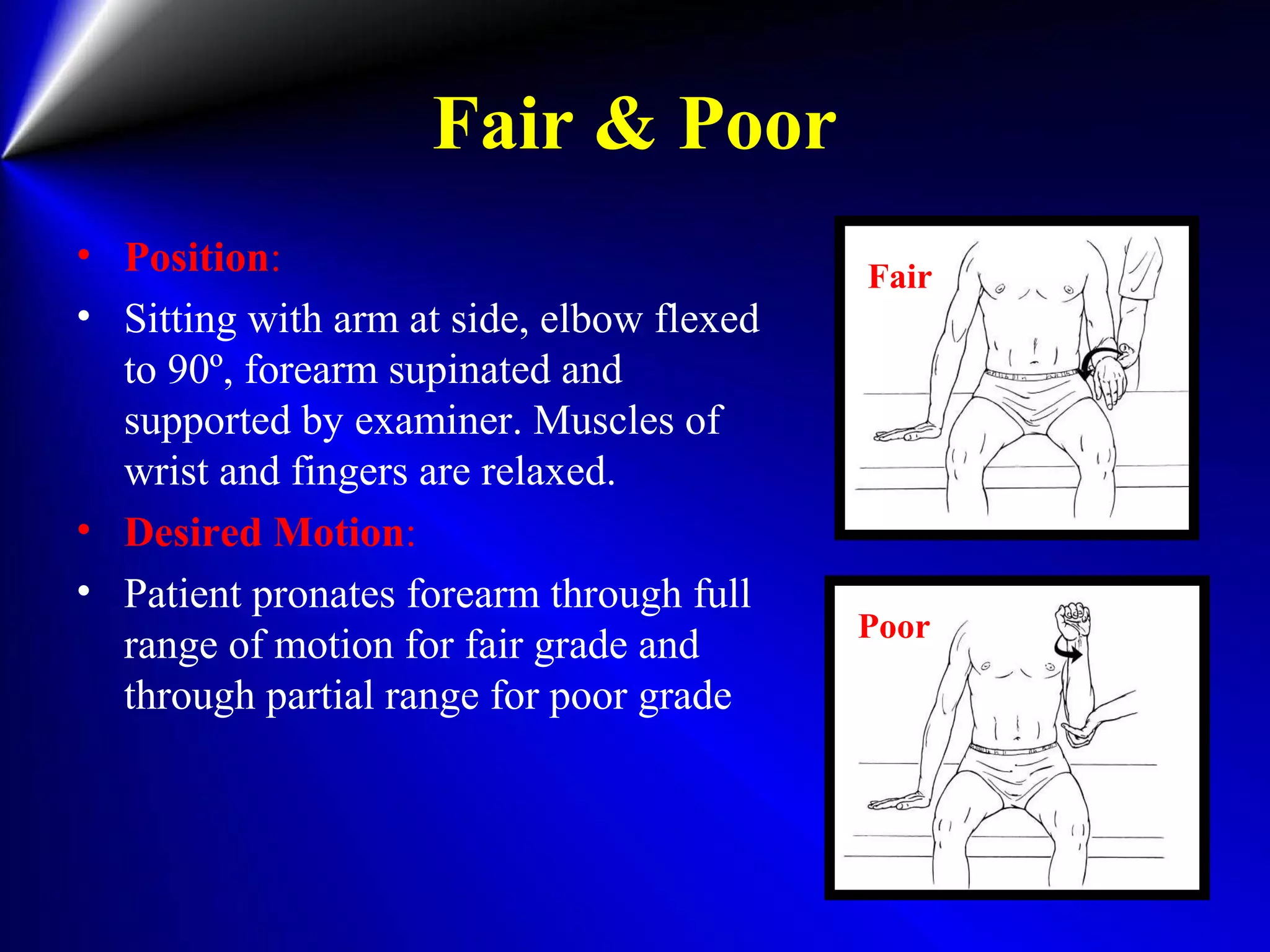 Fair & Poor
• Position:
• Sitting with arm at side, elbow flexed
to 90º, forearm supinated and
supported by examiner. Muscles of
wrist and fingers are relaxed.
• Desired Motion:
• Patient pronates forearm through full
range of motion for fair grade and
through partial range for poor grade
Fair
Poor
 