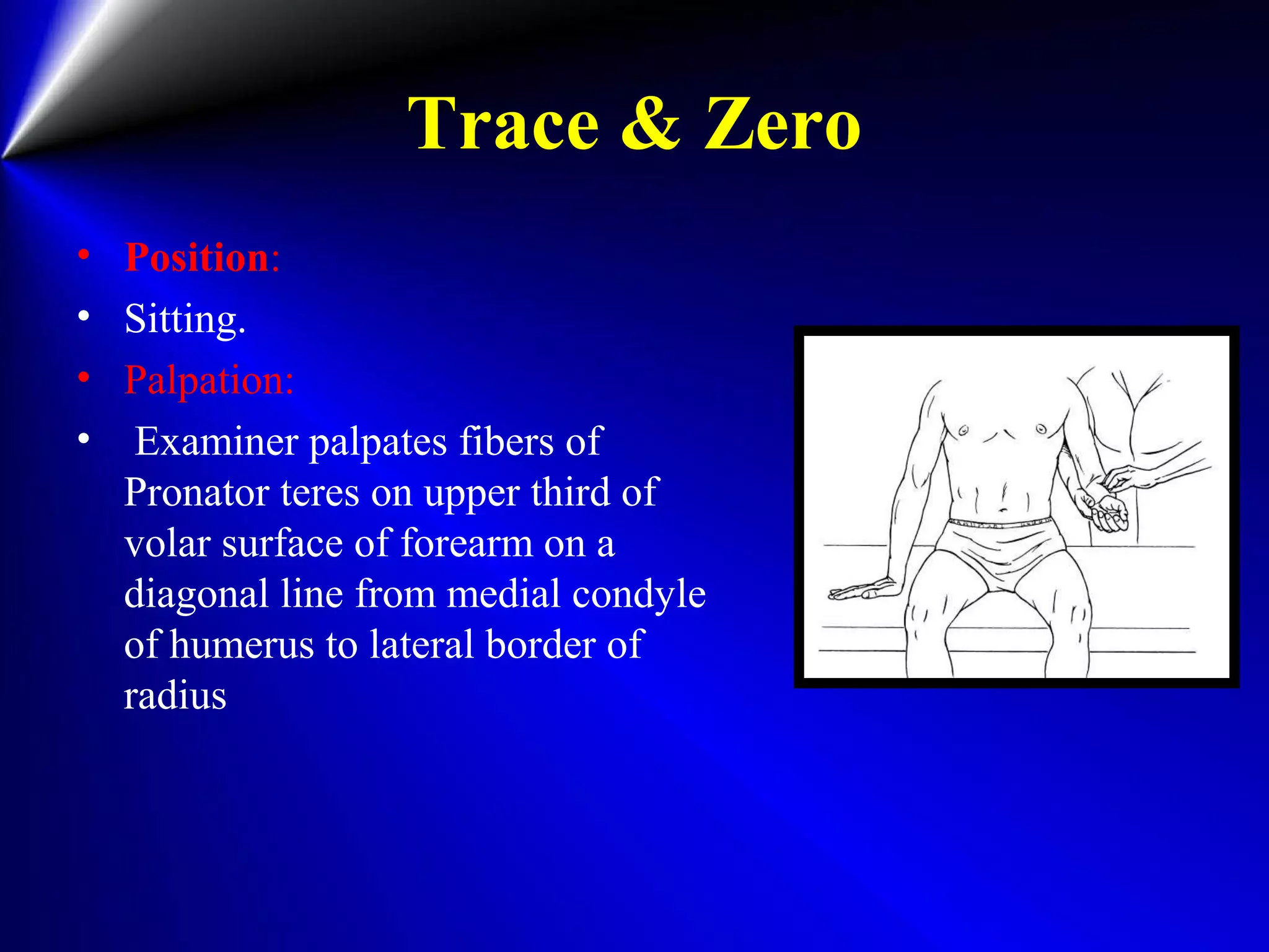 Trace & Zero
• Position:
• Sitting.
• Palpation:
• Examiner palpates fibers of
Pronator teres on upper third of
volar surface of forearm on a
diagonal line from medial condyle
of humerus to lateral border of
radius
 
